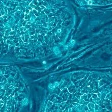 Placeholder Image Placeholder Image